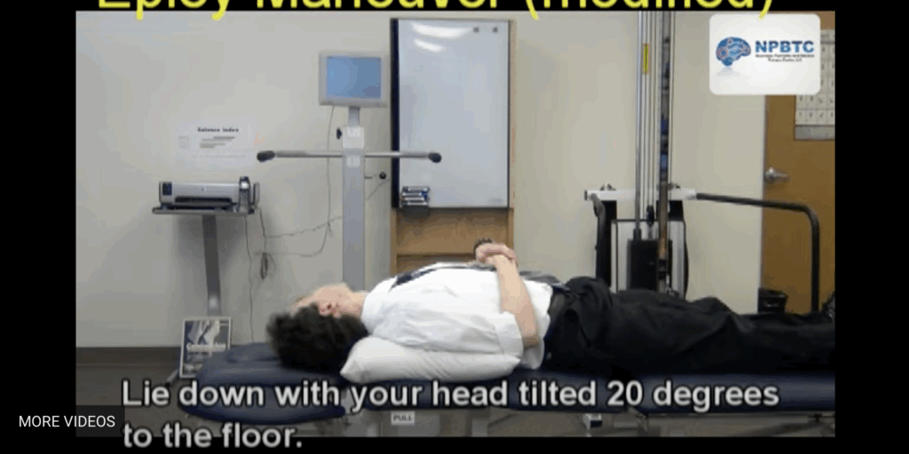 Epley Maneuver (modified) Video